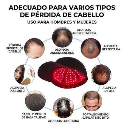 Gorro de crecimiento del cabello (Copia)